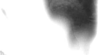 Still 1 from this detection